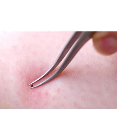 Faude Tick Tweezers - 8cm Stainless Steel Tick Remover | Safe No-Squeeze Design for All Tick Sizes - Buy Online on GoSupps.com