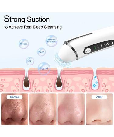Blackhead Remover Pore Vacuum | 1080P WiFi Facial Cleaner & Skin Care Tool | Acne & Blackhead Extractor with 20X Magnification - Buy Online on GoSupps.com