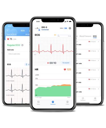 Wellue DuoEK-S Personal ECG Monitor - Bluetooth Wireless Portable Heart Monitor with OLED Screen - iOS & Android App - 30s to 5 Min Monitoring - Buy Online on GoSupps.com