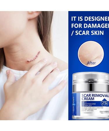 50ml Skin Repair Stretch Mark & Scar Removal Cream - Effective Surgery, Injury & C-Section Scar Lightening Treatment & Toenail Clippers Removal Solution - Buy Online on GoSupps.com