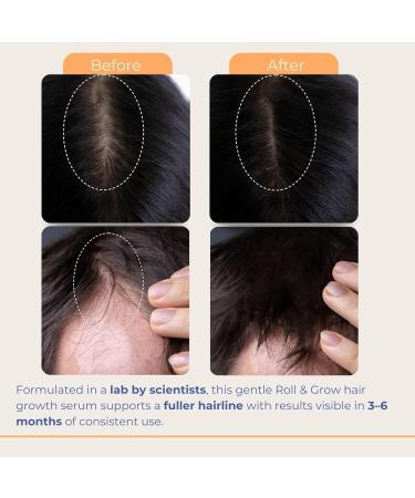 Ce puissant soin du cuir chevelu base de plantes en roll-on soulage naturellement la perte de cheveux et les d mangeaisons favorise la pousse des cheveux et stimule les follicules pileux 1Pcs - Buy Online on GoSupps.com