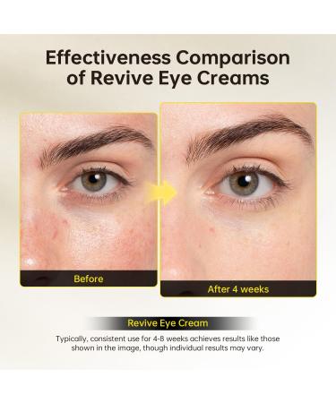 Revive Eye Cream with Retinal Niacinamide Reduces Under-Eye Bags Fine Lines Dark Circles and Wrinkles Stimulates Cell Renewal & Firms Skin. Korean Skin Care 40g(1.40 fl. oz) - Buy Online on GoSupps.com