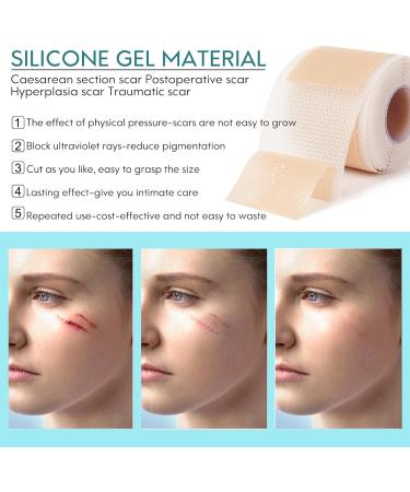 Silicone Scar Sheets 1.6x157 for Surgical Scars, C-Section, Keloid, Burn, Acne - 4M-157 - Buy Online on GoSupps.com
