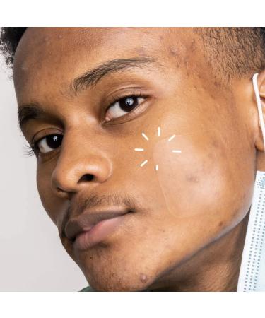 Avarelle Acne Cover Patch XL - 8 Extra Large Patches for Fast Pimple Relief - Buy Online on GoSupps.com
