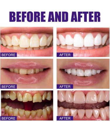 Colour Corrector Toothpaste for Effective Tooth Stain Removal | Purple Toothpaste for Vibrant Smiles - Shop Now - Buy Online on GoSupps.com