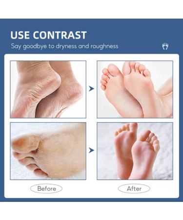 60% Urea Cream - Cracked Heel Repair Cream For Feet and Hand - Foot Cream for Cracked Heels and Dry Skin - Urea Cream 60 Percent for Feet - Maximum Strength for Hand Foot and Body Care - Buy Online on GoSupps.com