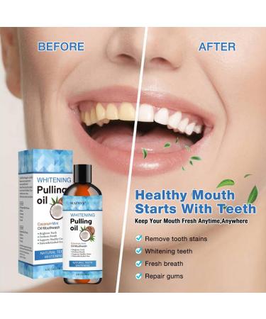 Coconut Pulling Oil with Tongue Scraper - Alcohol-Free Mint Oil Pulling Mouthwash for Fresh Breath - Natural Coconut Oil for Oral Care - Buy Online on GoSupps.com