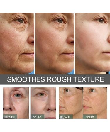 Caffeine Solution 5% + Egcg Caffeine Eye Cream For Wrinkles Caffeine & Hyaluronic Acid Under Eye Serum Caffeine Eye Serum Anti Aging Under Eye Cream For Reduce Circles And Puffy Eyes Eye Bag Removal - Buy Online on GoSupps.com