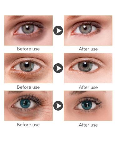 Fixed Eye Serum 30ml - Anti-Dark Circles & Puffiness Moisturizing Eye Solution for Women - Buy Online on GoSupps.com