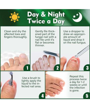 Fungal Nail Treatment 30ML - Extra Strong Solution for Toenails & Fingernails - Restores Healthy Nails - Protects Thick, Broken, and Discolored Nails - Green-1 - Buy Online on GoSupps.com