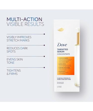Dove Targeted Serum for Stretch Marks & Dark Spots - Nourishing Skin with Niacinamide Collagen & Tone Balance - 3.2 oz - Buy Online on GoSupps.com