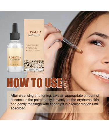 Rosacea Face Serum Anti Redness Face Serum for Women Relieve Redness & Acne Mark Dark Spot Correcting Glow Serum Anti Aging Serum for Face Hydrating Face Serum Skin Care for Women Dark Spots Remover - Buy Online on GoSupps.com