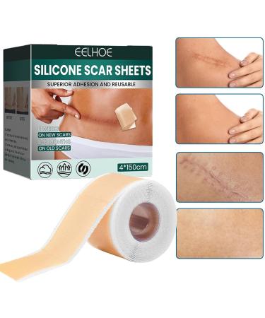 Teksome Silicone Scar Sheets - Stretch Mark Remover | Soften & Flatten Scars | For Surgery Injury Burns C-Section | 1.57*59 Inches - Buy Online on GoSupps.com