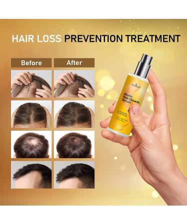 Biotin Hair Growth Serum with Castor Oil & Argan Oil for Women - Hair Loss Prevention and Regrowth Treatment by Beaueli - Buy Online on GoSupps.com