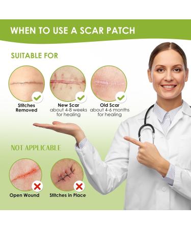 Buy AUSLKA Silicone Scar Sheets 1.6 x 120 Roll Professional Scar Tape for C-Section Tummy Tuck Keloid & Scar Treatments Fast International Shipping - Buy Online on GoSupps.com