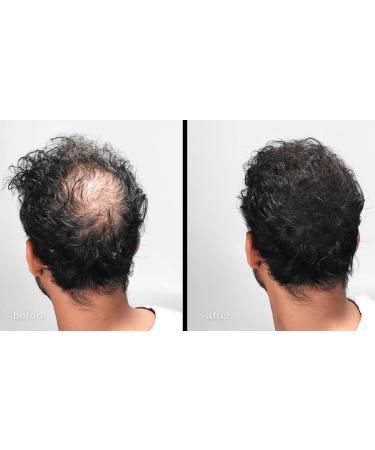 LUXE Hair Thickening Fibers - 2 Months+ Supply in Gray | Hypoallergenic & Dermatologist Tested for Confidence Boost - Buy Online on GoSupps.com