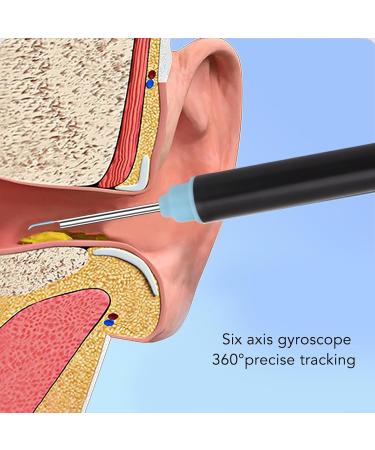 2MP 1080p Ear Wax Removal Camera - 360 View 6 LED Lights Safe & Hygienic Inspection for Ear Nose Mouth - Smartphone Connectivity - Buy Online on GoSupps.com
