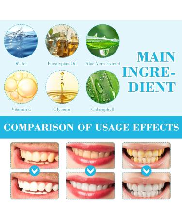 4 Pi ces Stylo Blanchiment Dents Gel Blanchiment Dentaire limine Les Taches Alimentaires Doux Ajustement Naturel Facile Utiliser Rafra chit L'haleine Portable Pratique Convient Un Usage Quotidien - Buy Online on GoSupps.com