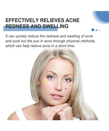 Buy Facial Acne Patches - Hydrocolloid Treatment with Tea Tree Oil & Salicylic Acid | 216 Tablets for Pimples & Blemishes - Buy Online on GoSupps.com