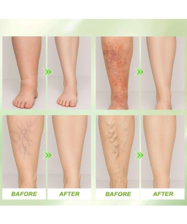 Nitidissima Miracle Balm - Soothing Joint Cream for Back Hands Feet and Body - Buy Online on GoSupps.com