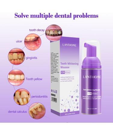 Tooth Mousse Oral Crystal - Purple Toothpaste for White Teeth - Whitening Mousse - Teeth Whitening Toothpaste - Color Correction - Buy Online on GoSupps.com
