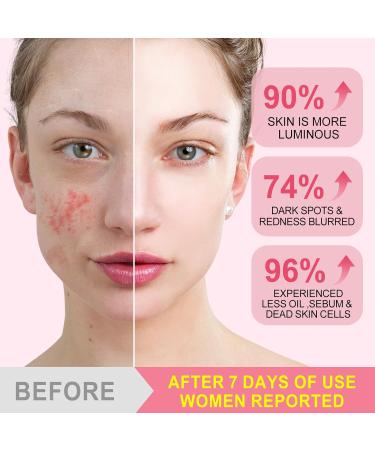  Feeliville Turmeric Pads Kojic Acid & Turmeric Pads Infused Foaming Exfoliating Pads for Dark Spots Dull Skin Unclog Pores Help Balance Skin Oil and Water (2  - Buy Online on GoSupps.com