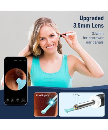 FTOYIN Ear Wax Removal Kit with 1080P Camera - iOS & Android Compatible - Buy Online on GoSupps.com