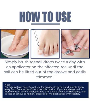 BaBound German Toenail Care Paronychia Oil German Toenailcare Removal Paronychia Oil Toenailcare Oil For Paronychia Removal German Toenailplus Anti Paronychia Relief Oil 1PCS - Buy Online on GoSupps.com