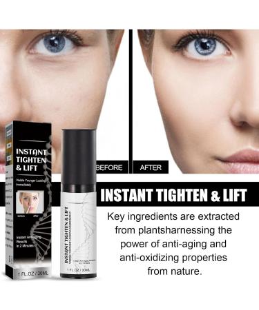 Harvey Ross - Instant Lift Harvey Ross Instant Lift Plus Dark Circles Instant Lift Harvey Ross Instant Lift Creme Instant Lift Yeux Creme Skin Firming Under Eye Cream for Wrinkles (1) - Buy Online on GoSupps.com