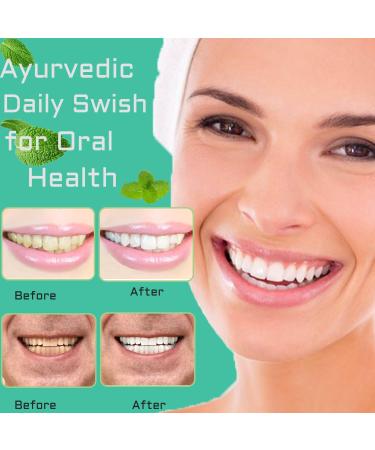 Coconut Pulling Oil - Mint Oil Pulling Mouthwash for Whiter Teeth & Healthy Gums | Natural Oral Care Alcohol-Free (8 Fl.Oz - Buy Online on GoSupps.com