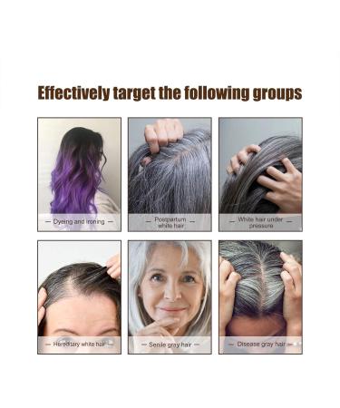 Reverse Gray Hair Natural Nourishing Hair Growth Essence Volumizing Anti Gray Hair Essence 30ml Men Women Hair Care for Shiny Healthy Black Hair Eastuy - Buy Online on GoSupps.com