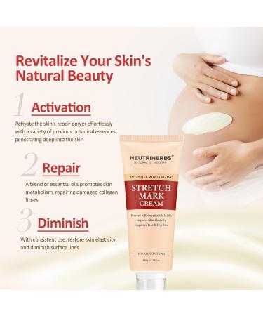 Neutriherbs Stretch Mark Cream - Best Pregnancy & Weight Fluctuation Skin Care with Shea Butter & Coconut Oil - 3.88 Oz - Buy Online on GoSupps.com