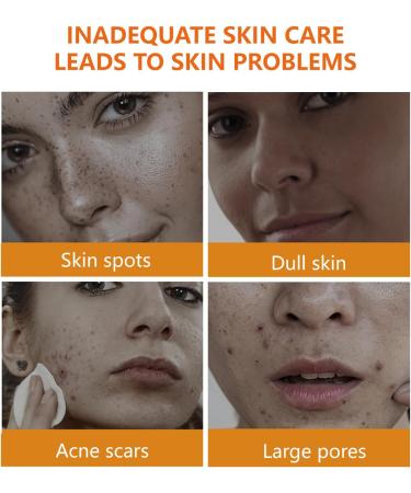  MagiSel Turmeric Toner Facial Toner Turmeric Skin Toner Astringent Pore Lightening Skin Brightening Anti-Aging Facial Toner Daily for All Skin Types 100ml - Buy Online on GoSupps.com