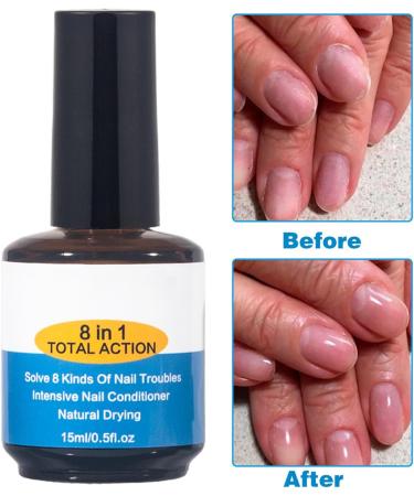 ASMAYSA Nail Strengthening Treatment-Nail Therapy-8 in 1 Total Action Concentrated Hardening & Strengthening Polish Nail Serum Nail Growth Activator Nail Repair Weak Thin Soft Peeling Nails - Buy Online on GoSupps.com