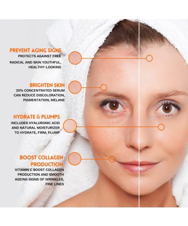 20% Vitamin C and Hyaluronic Acid Serum Set - Boost Collagen Hydrate and Plump Skin Reduce Fine Lines and Wrinkles - Buy Online on GoSupps.com