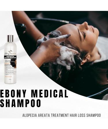 Alopecia Areata Treatment Hair Loss Shampoo - Best Hair Growth Solution for Thinning Hair & Receding Hairlines - 12 fl oz - Buy Online on GoSupps.com