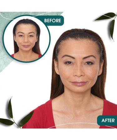 Grofully Women's Hair Regrowth Kit - Gold | 3-Step System with Shampoo, Conditioner, and Minoxidil 2% | Hair Loss Treatment Set - Buy Online on GoSupps.com