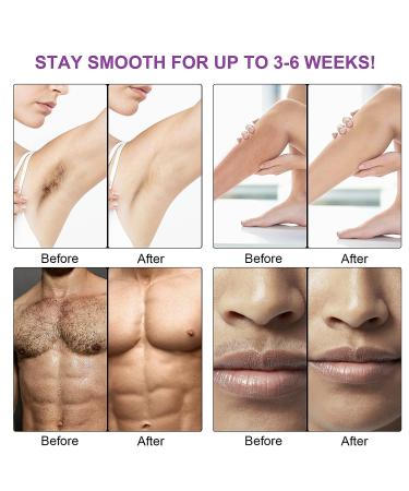 NYANDU Waxing Kit for Women Men - 17.6 oz Wax Beads (5 Packs) - Professional Hard Wax Kit for Coarse Hair Removal - Ideal for Facial, Eyebrow, Legs, Armpit, Bikini, Brazilian - Home Wax Machine - Buy Online on GoSupps.com