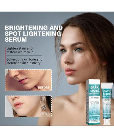 Fade Stain Beauty Cream Freckle Remover Cream Dark Spot Remover for Face Dark Spot Correcting Glow Serum Dark Spots Remover Dark Spot Corrector Cream Age Spot Remover Dark Spot Cream Spot Remover - Buy Online on GoSupps.com