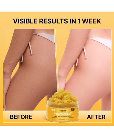 Exfoliating Body Scrub Bikini Area Exfoliator Ingrown Hair Treatment Razor Bumps Treatment for Women Kojic Acid Turmeric &AHA/BHA Smooth Brighten& Even Skin Tone for Bikini Underarm &Inner Thighs - Buy Online on GoSupps.com