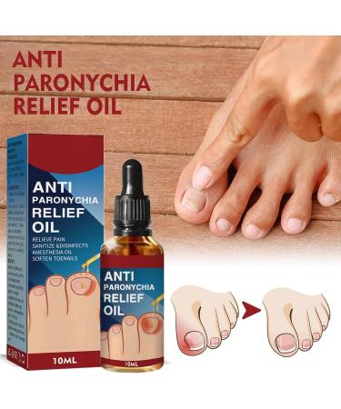 Ingrown Toenail Treatment Oil - 2PCS | Anti-Paronychia Relief & Ingrown Toenail Correction Drops - Buy Online on GoSupps.com