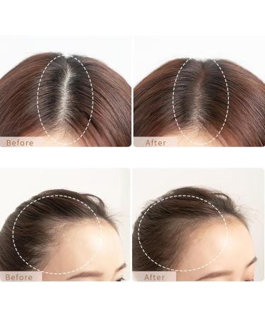 Magic Building Fiber Powder Hair Fibers for Thinning Hair for Women and Men Hair Fillers for Thinning Hair Undetectable Thicker Looking Hair for Men & Women (Color : Brown Size : 3Count (Pack of 3Count (Pack of 3) Brown - Buy Online on GoSupps.com