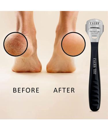 FACN Professional Pedicure Callus Shaver Remover - 50 Blades Included - Surgical Grade Stainless Steel - Salon Quality Tool for Removing Calluses, Corns & Rough Skin - Buy Online on GoSupps.com