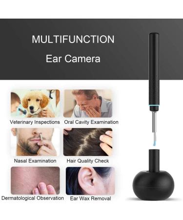 Intelligent Wireless Otoscope Earwax Removal Kits with 3 Million High-Precision Endoscope Widely Compatible Magnetic Charging Base for Daily Cleaning and Care Green - Buy Online on GoSupps.com