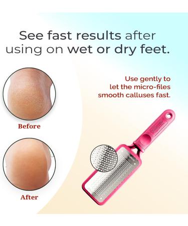 Microplane Colossal Foot File Scraper - The Original Stainless Steel Foot Rasp Dead Skin/Callus Remover for Feet Gentle Foot Scrubber Pedicure Tools for Salon-Quality Foot Care Pink Disposable - Buy Online on GoSupps.com