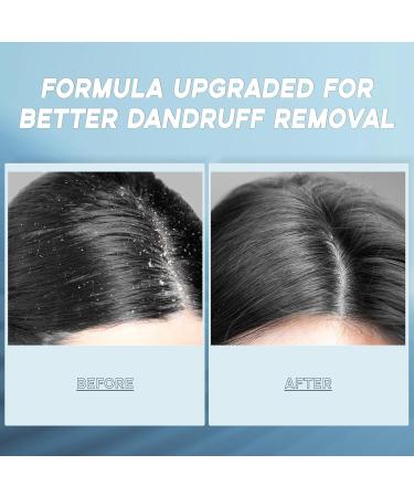 Exfoliating Scalp Scrub Treatment - Sea Salt Coconut Oil & Ginseng for Dandruff Relief | Large 11.99 fl oz | Dry Itchy Flaky Scalp Solution - Buy Online on GoSupps.com