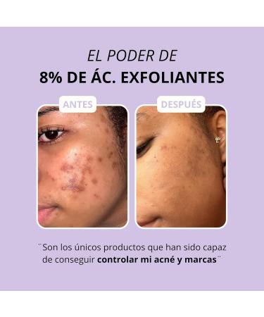  Nonna Cosmetics Nonna Cosmetics GGLOW 5% - Face cream for enlarged pores blemishes and acne - Glycolic acid & niacinamide - 10 ml (travel size) (10 ml) - Buy Online on GoSupps.com