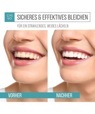 Teeth Whitening Kit: Toothpaste Activated Carbon Powder & Toothbrush for Stain Removal & Brightening - Buy Online on GoSupps.com