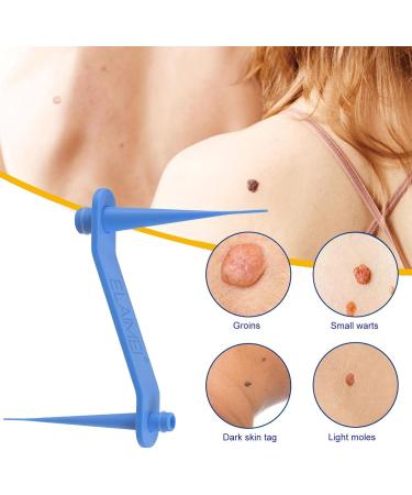 Skin Tag Removal Two-Strip Fast Auto Tag Removal Kit Skin Tag Repair with 40 Elastic Bands for Face Neck - Buy Online on GoSupps.com