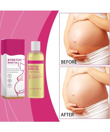 Stretch Mark Oil | Pregnancy Oils for Stretch Marks | Pregnancy Stretch Oil | 100ml Pregnant Belly Oil | Pregnant Skincare Oils | Pregnant Body Oils for Stretchy Mark Prevention - Buy Online on GoSupps.com